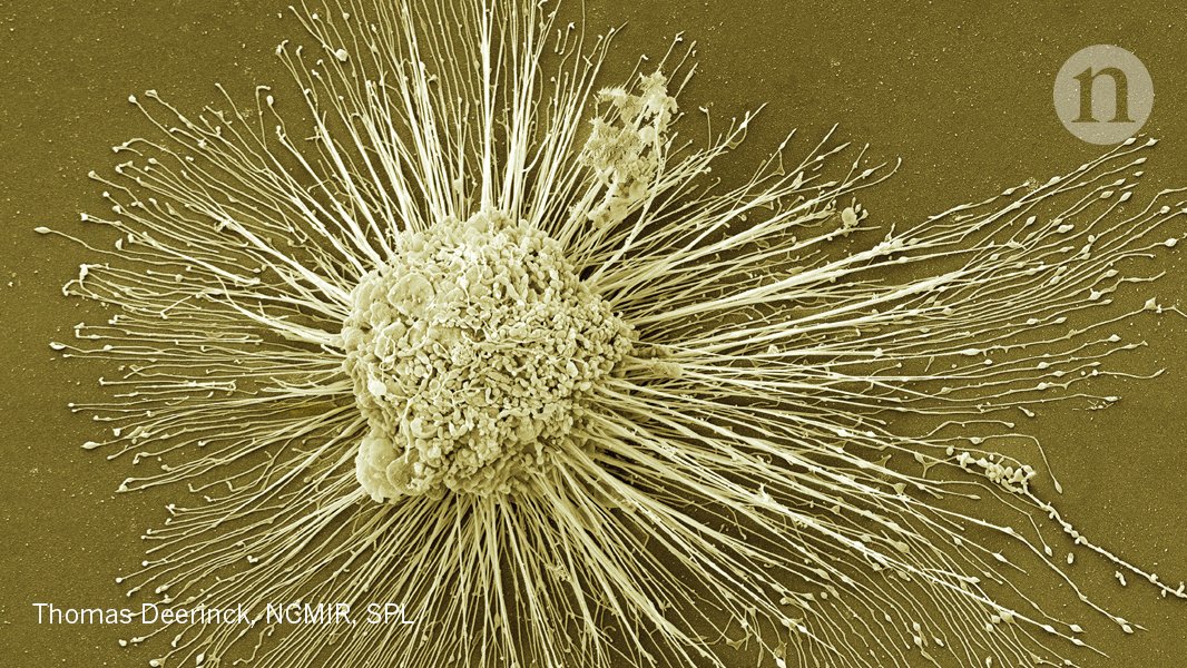 Japanese man is first to receive 'reprogrammed' stem cells from another person: go.nature.com/2nflJVc