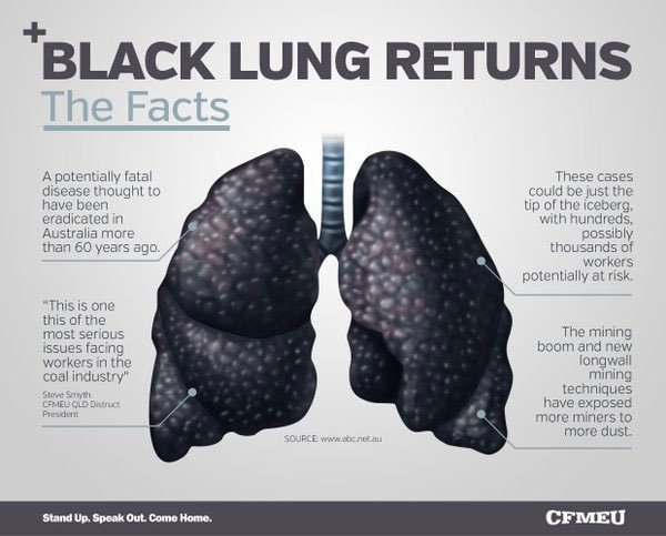 bigdaddyspring6's tweet photo. #CleanPowerPlan bring back pollution contaminated water acid rain and black lung. @realDonaldTrump winning. #Fscience @CNN @MSNBC @FoxNews https://t.co/6rQRVUrzFw