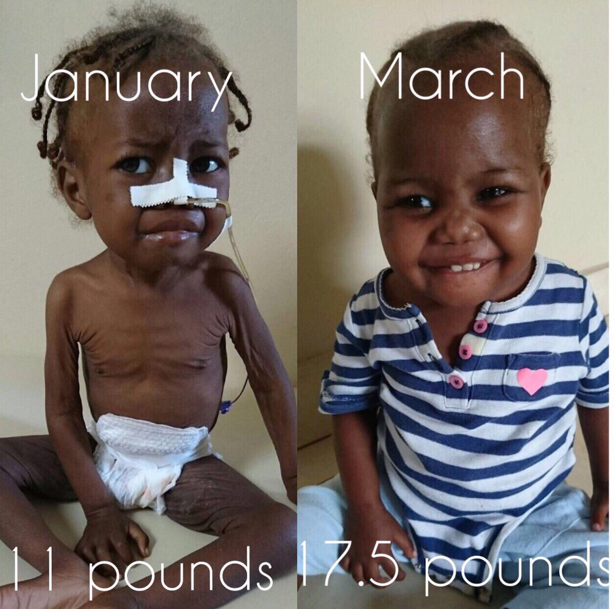 DanitasChildren's tweet image. Neika was so malnourished &amp;amp; sick when she came to our med center. Today she's healthy &amp;amp; happy! #transformation #malnutrition