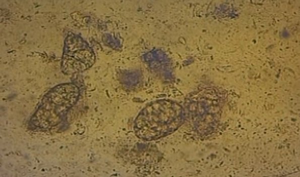 Бактерии в копрограмме. Микроскопия кала яйца гельминтов. Яйца гельминтов препарат микроскоп. Яйца гельминтов огуречного цепня.