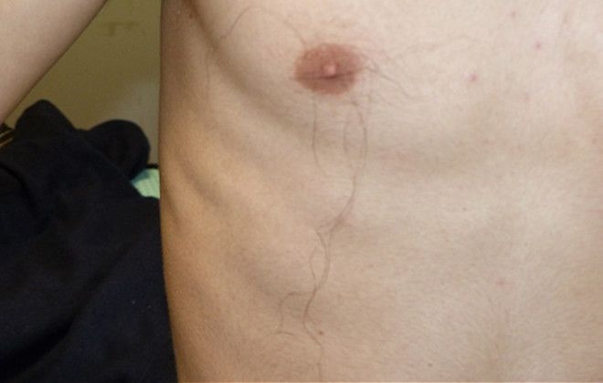 Uberfacts On Twitter The Longest Nipple Hair Ever Recorded Was