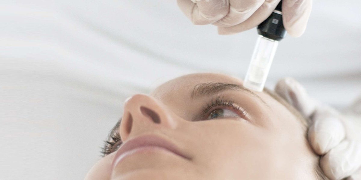 SkinBodyRenewal's tweet image. Dermapen what's all the fuss about? bit.ly/dermapenSR1 #SkinRenewalSA #Dermapen @Dermapen #skinneedling #aesthetics