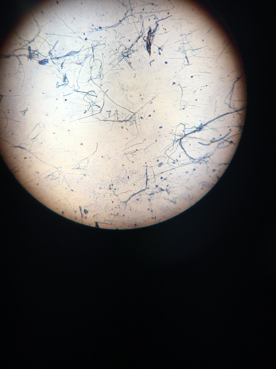 APIAtaldea's tweet photo. These are some of the examples we saw with the microscope #BIODIVERSITYLAB @NSPC_I https://t.co/Sre5JwtO3S