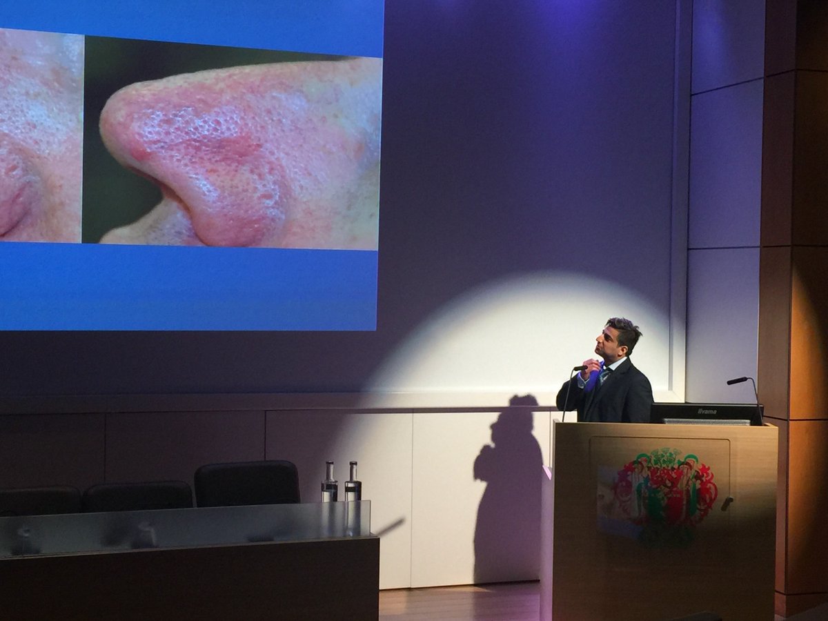 CynosureEMEA's tweet image. A fascinating talk by Dr Saquib Bashir at the Introduction to Laser Dermatology event in London.#powerfullessons #powerfullresults #cynosure