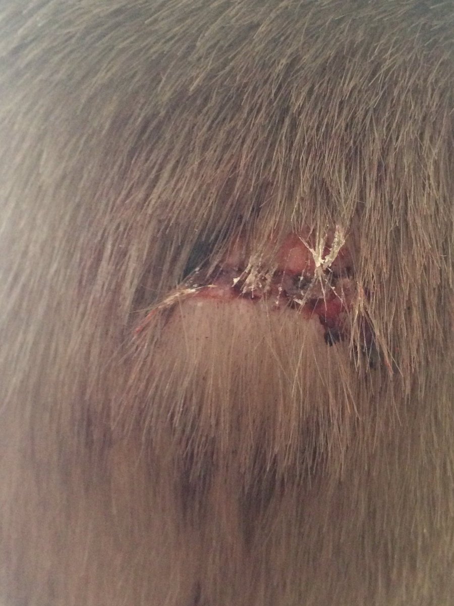 Ty_TheTiger06's tweet photo. Today at school I cracked my head open and this is what it looks like this the one on the l is befor glue and r is after being glued https://t.co/R8uCMJfo8q