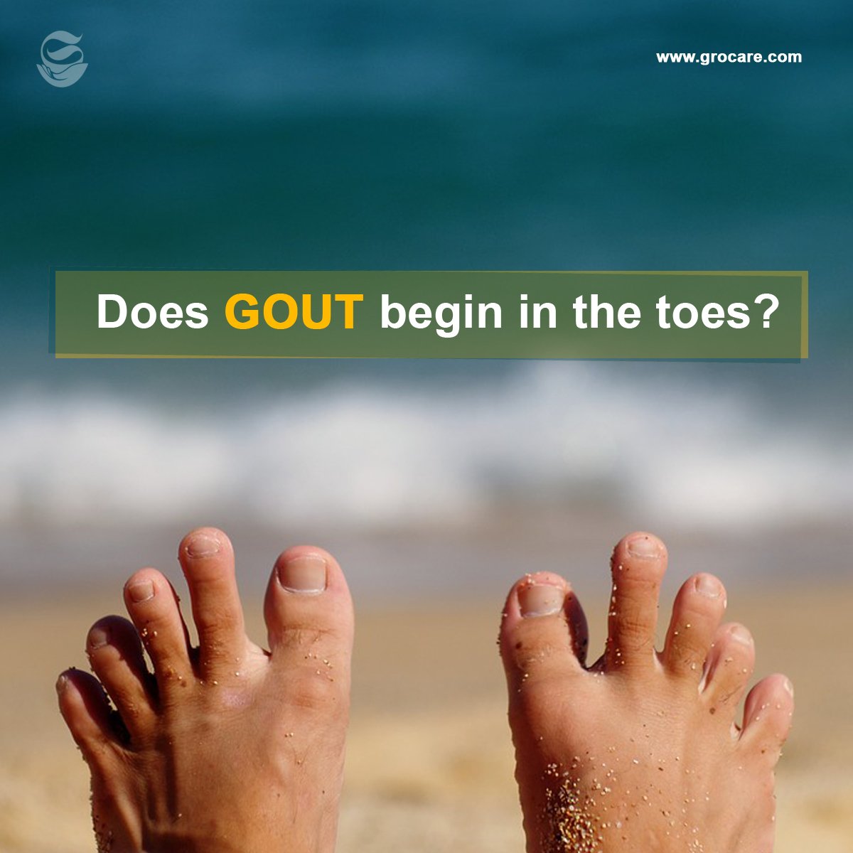 Grocare_India's tweet photo. The accummulation of #uricacid tends to take place in extemes, such as the toes. Many experience the onset of #gout there #healersofindia https://t.co/yh85drAfqA