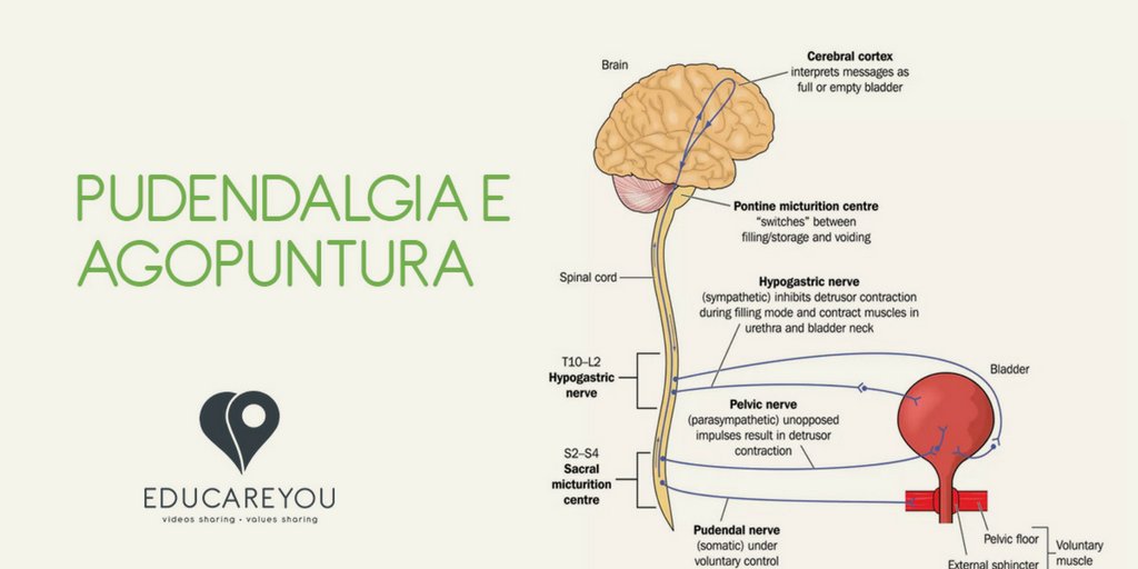 EducareYou's tweet photo. #Agopuntura come #possibile #rimedio alla #pudendalgia. Ne parlano i nostri #esperti per la #community in un #video: https://t.co/rTfR51a2ZJ https://t.co/iQpWimCpKo
