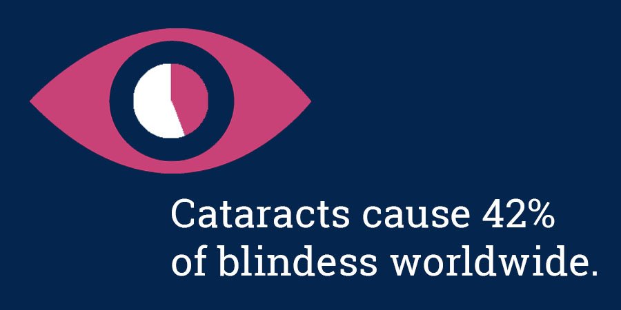 PEACHTREE_study's tweet photo. #Cataracts are one of the most common complications in #uveitis patients as a result of chronic inflammation &amp; prolonged corticosteroid use https://t.co/H2usMRuUOM