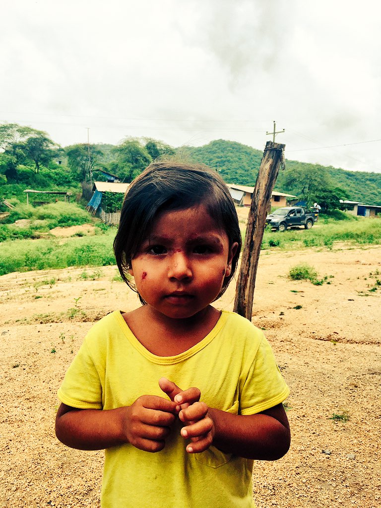 GrundyAlan's tweet photo. Field Visit in Palo Blanco, Chulucanas children with open sores from insect bites @CRSnews #perufloods #peru https://t.co/w2y5GleTrH