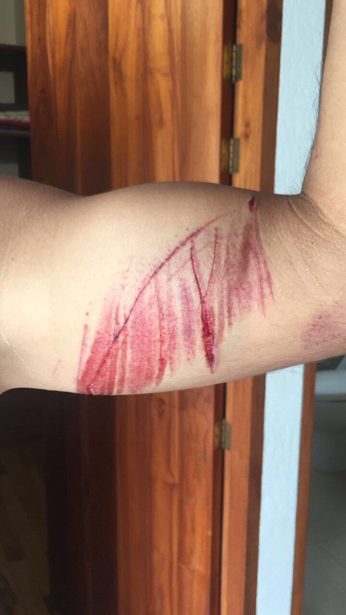 UranRigoberto's tweet photo. Mijos estoy triste,q un conductor atropelle un ciclista y luego se marche sin importarle nada.Completa indignación #nomasinsensibilidad https://t.co/adDLSS9xgG