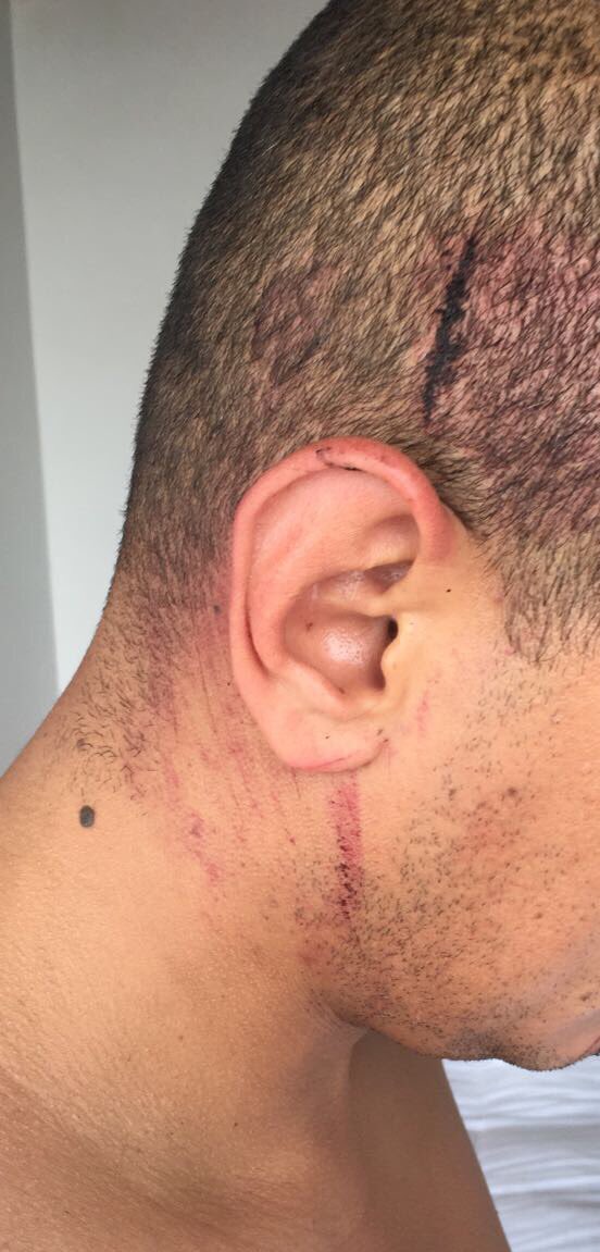 UranRigoberto's tweet photo. Mijos estoy triste,q un conductor atropelle un ciclista y luego se marche sin importarle nada.Completa indignación #nomasinsensibilidad https://t.co/adDLSS9xgG
