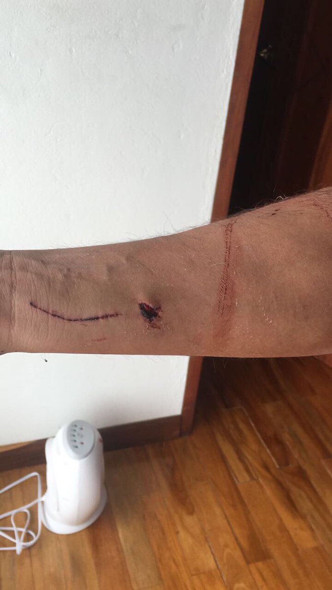 UranRigoberto's tweet photo. Mijos estoy triste,q un conductor atropelle un ciclista y luego se marche sin importarle nada.Completa indignación #nomasinsensibilidad https://t.co/adDLSS9xgG