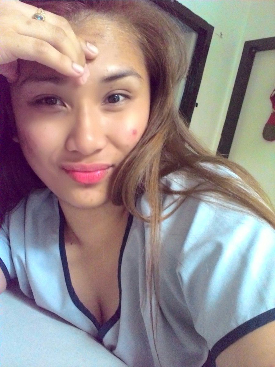 Eh na bored ako eh!!!.... may forever sa pimples #privatedutynurse #buhaynars #dutymode