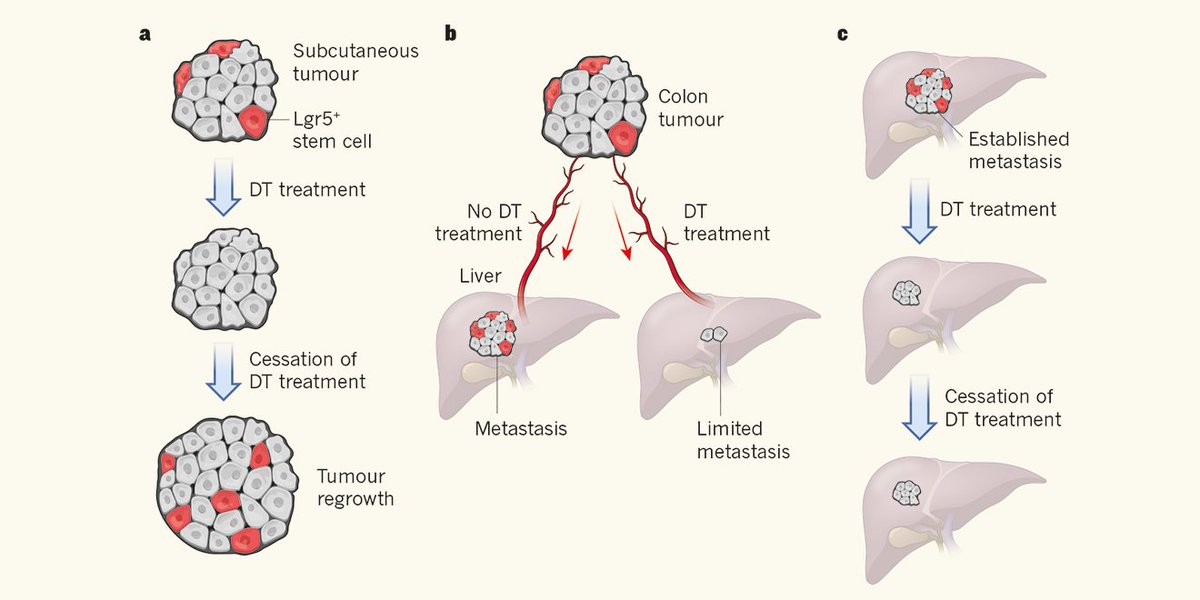 NatureNV's tweet photo. Targeted removal of a stem-cell population reveals its role in tumour growth and metastasis https://t.co/AllAJk3iuD https://t.co/R2ktvjZ56X