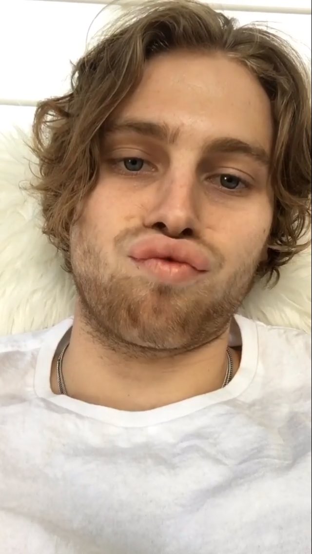 5SOS_Daily's tweet photo. I'M NOT FINE AT ALL https://t.co/MT0IaHjhzu