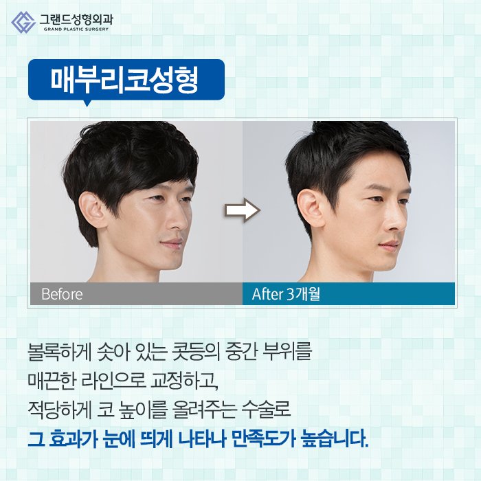 Grand_PS's tweet image. 코는 얼굴의 중심인만큼 많은 사람들이 이미지 변신을 생각할 때 고려하게 되는 코성형! 오똑한 모양만을 추구하는 것보다 내 얼굴과 어울리고 적당한 각도와 비율을 고려해야 예쁜 모양을 완성할 수 있다는 사실♥#그랜드성형외과 #코성형 #코수술 #beauty