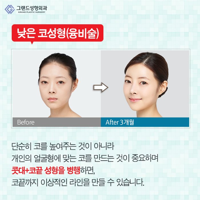 Grand_PS's tweet image. 코는 얼굴의 중심인만큼 많은 사람들이 이미지 변신을 생각할 때 고려하게 되는 코성형! 오똑한 모양만을 추구하는 것보다 내 얼굴과 어울리고 적당한 각도와 비율을 고려해야 예쁜 모양을 완성할 수 있다는 사실♥#그랜드성형외과 #코성형 #코수술 #beauty