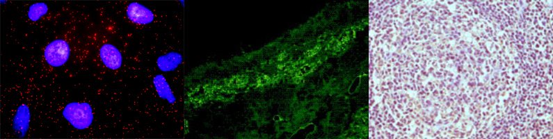 Abnova1's tweet photo. B-lymphocyte antigen #CD19 is the most common target of #CAR T cell therapy. Find out #CD19 study tools from #Abnova https://t.co/qshmJJ8oaC https://t.co/YIkiUfkNqB