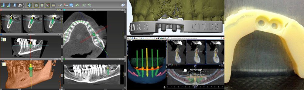 CTARSIN's tweet photo. Get the best out of #technology with #CTARS custom-made Implant Positioning System (IPS). Learn more: https://t.co/HFZbXOwDpO
#3DPrinting https://t.co/89GjzDskNE