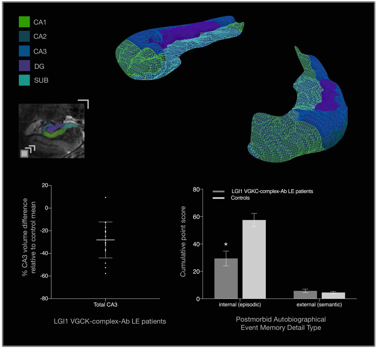 Brain1878's tweet photo. Focal CA3 hippocampal subfield atrophy following LGI1 VGKC-complex antibody limbic encephalitis https://t.co/a0826sysfC https://t.co/4B4r0AzHl4