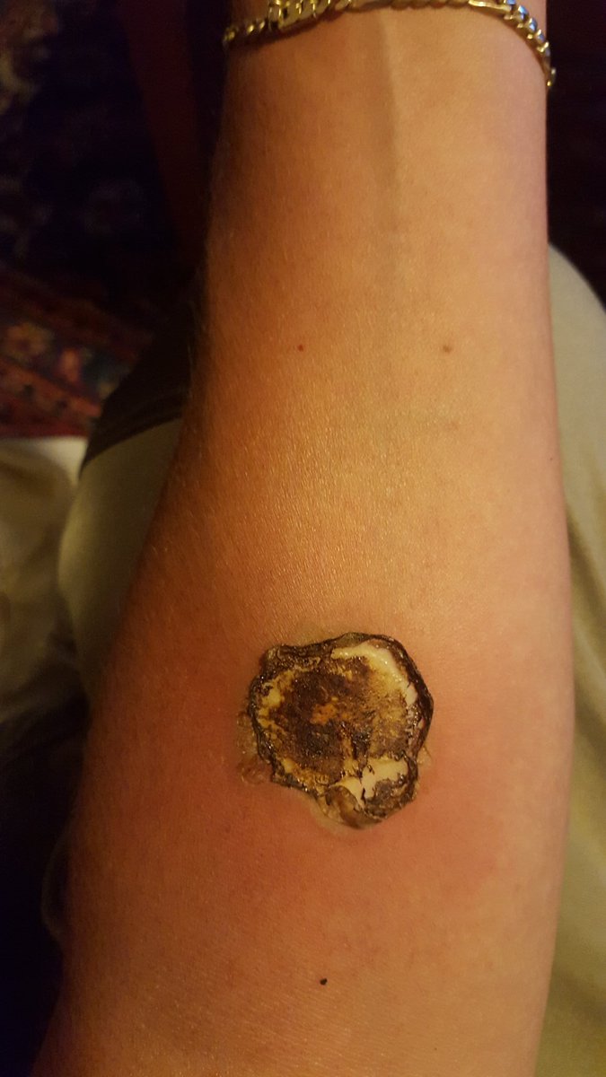 KrisErickson77's tweet photo. My last marking after 24 tattoos and this. The end https://t.co/AxwNed53Jt