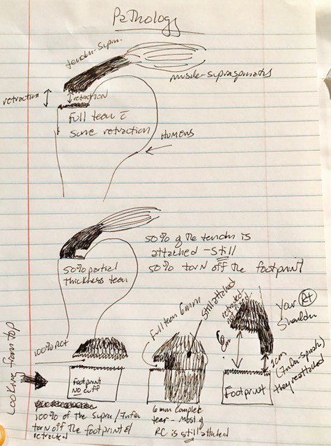 Injury is a part of Racing stevetilford.com/2017/03/31/inj…