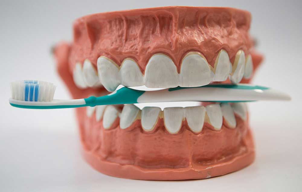 AllScan3D's tweet image. I Tried Whitening My Teeth at Home. Here's What Happened. buff.ly/2opyw8p