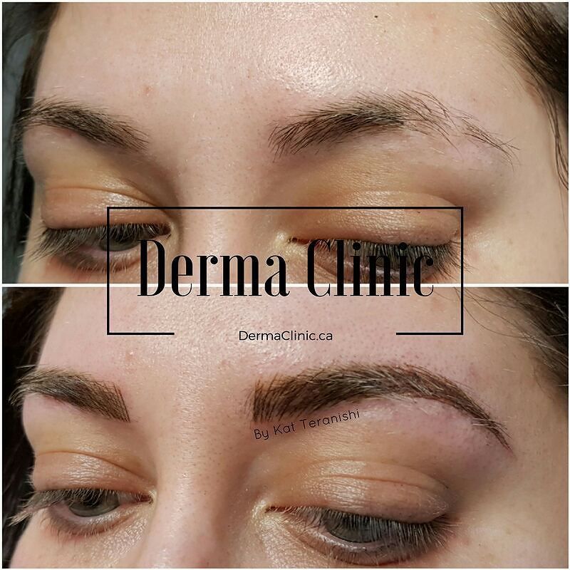 DermaClinicBC's tweet photo. A little combo shade/microblade gives these brows shape and definition.  Looking good. 
#browsonpoint #brows #3dbrows #featherbrows #touchu… https://t.co/5gQdTc9Dkt