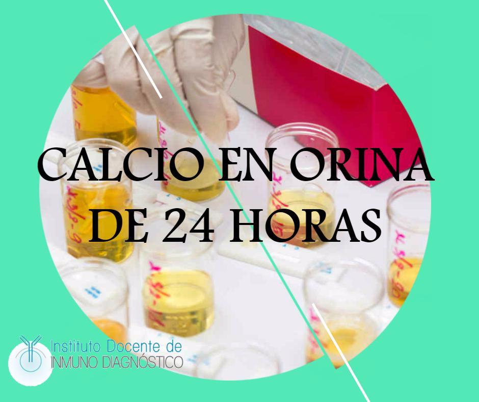 ididca's tweet photo. ¿Necesitas medir la cantidad de calcio que tienes en la orina? Visítanos y hazte el examen indicado aquí #Laboratorio #Caracas #ElRosal https://t.co/sPh35SmYO9