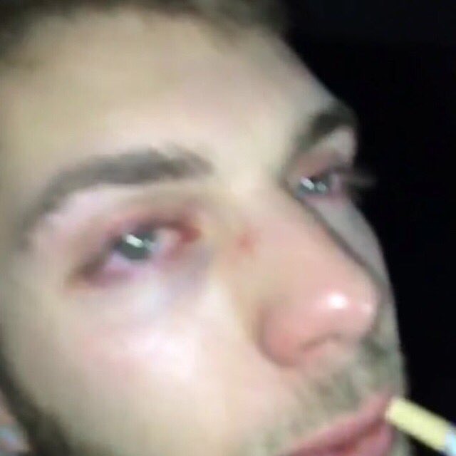 milesallen47's tweet photo. "Wyd after hitting this?" https://t.co/5kgovu8wjx