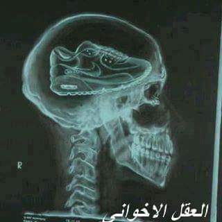 SHERIF_RSHAD's tweet photo. حقيقة مؤكدة كحقيقة الموت العقل الخرفاني https://t.co/nuZ19Sqpv9
