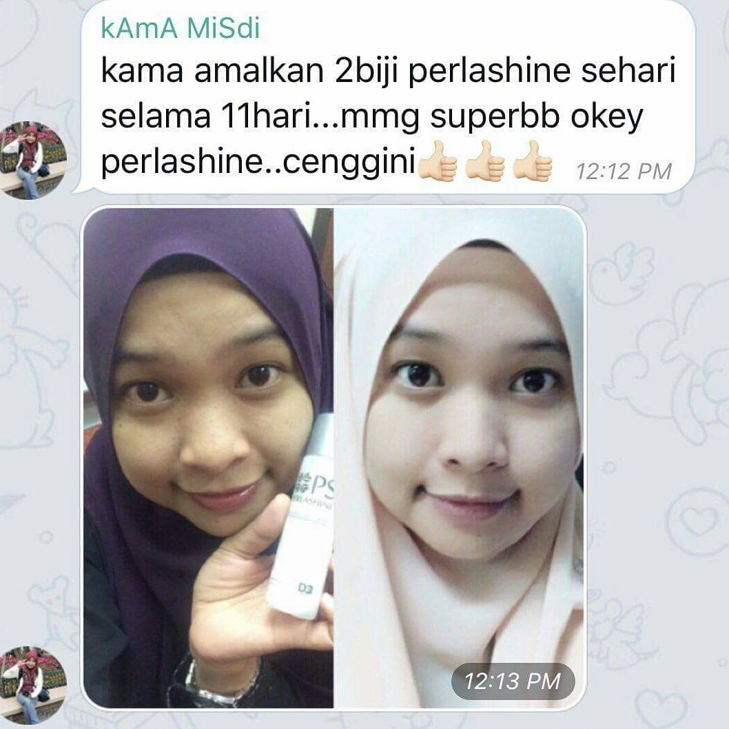 asmahlieza's tweet photo. Hari ni malas nak cakap banyak, layan jelah testimoni Perlashine. 

Wasap 017-710 3189 untuk order. https://t.co/uIcW7cAGFh
