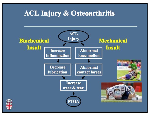 ManningGolfPT's tweet photo. #ACLtear not just a mechanical issue #NErehabsummit #biomechanic #thisstuffiscool #learnedsomethingnew https://t.co/V84fZiRwfH