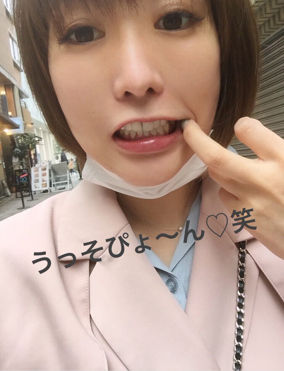 歯抜け