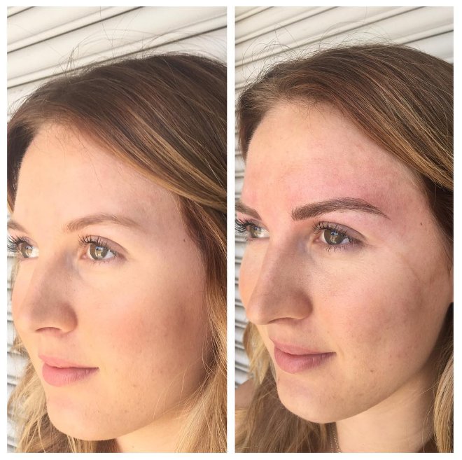 Msbrowsaz's tweet image. Thank you to my clients who trust me with their brows. I love having the skill of microblading!! #microblading #permanentmakeup #tattoo