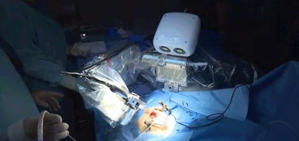 juvehc_herrera's tweet photo. Surgery of the future - the first #robot-assisted cochlear implantation has been completed.... https://t.co/dcjACWsW0J https://t.co/oZqjFft9X1