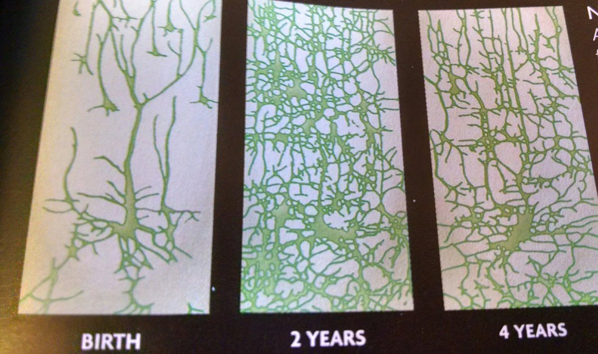 ThisBrainTweets's tweet photo. 1/6 of the brain is developed before birth, huge growth in first 3 yrs, pruning of fibers by 4. First years are essential!

Neural networks https://t.co/HSBK5gqe7M