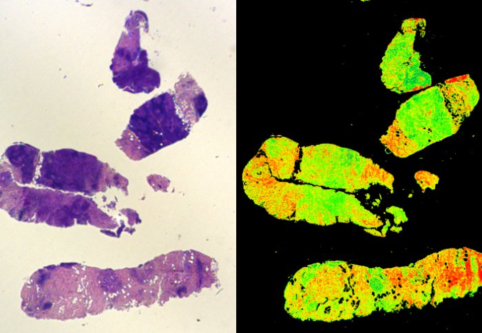 Technology that could detect #cancer more accurately wins Innovation Award www3.imperial.ac.uk/newsandeventsp…
