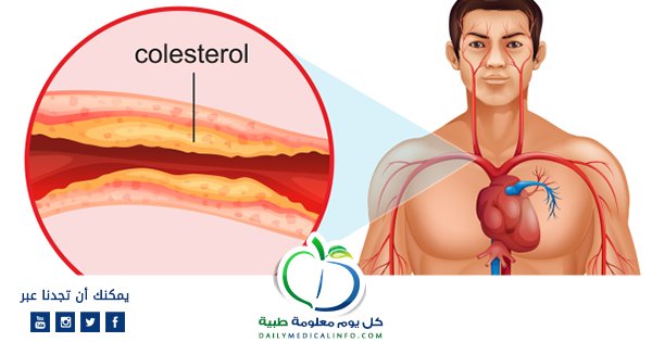 DailyMedicalinfo ديلي ميديكال انفو tweet media