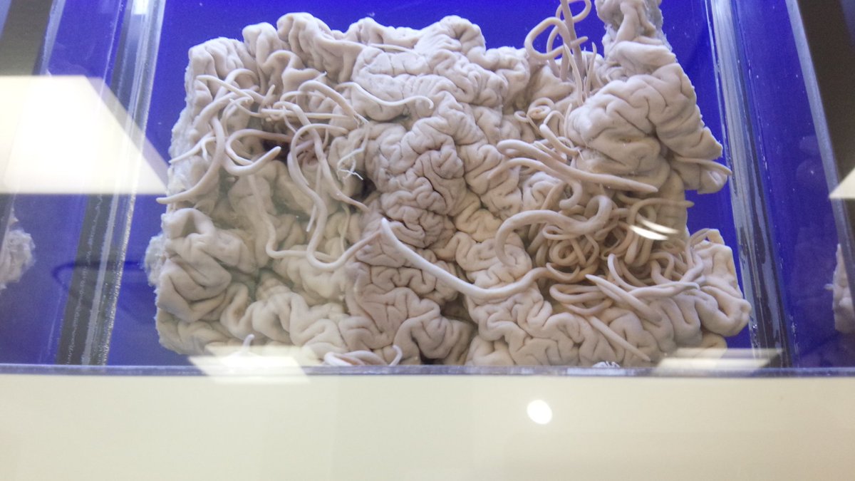 悠泰 公益財団法人目黒寄生虫博物館は世界の様々な寄生虫や日本の寄生虫科学者について展示されています 地元ではデートスポットとしても人気らしいです 入場料が無料なので皆さんも是非行ってみて下さい 153 0064東京都目黒区下目黒4 1 1 悠泰 公益財団法人目黒寄生虫博物館は世界の様々な寄生虫や日本の寄生虫科学者について展示されています 地元ではデートスポットとしても人気らしいです 入場料が無料なので皆さんも是非行ってみて下さい 153 0064東京都目黒区下目黒4 1 1