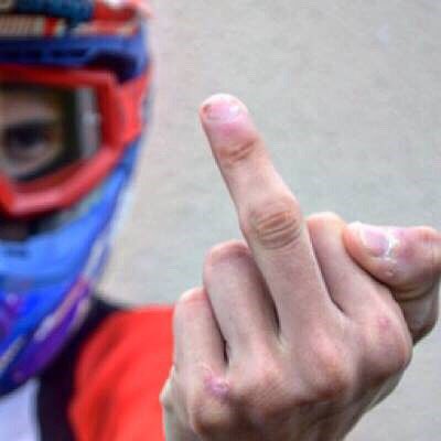 Nicolasagne4's tweet photo. Fuck les réparerateur de bike qui mettent 3 semaines à commander un cintre et un jeu de direction! 🖕🏽🖕🏽🖕🏽🖕🏽🖕🏽🖕🏽🖕🏽🖕🏽 https://t.co/VNl5ByiM6c