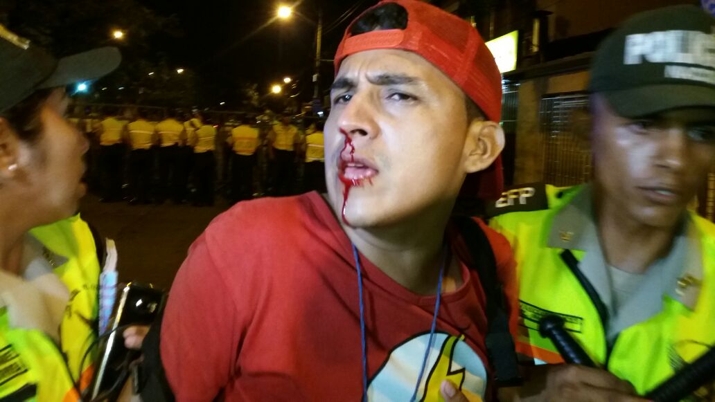 Soldelkastillo's tweet photo. Lamentable que lleguemos a ese nivel de violencia...Mi solidaridad con mi amigo #MarcosPin (Fotógrafo de Agencia Api) https://t.co/oV3PagbyFV