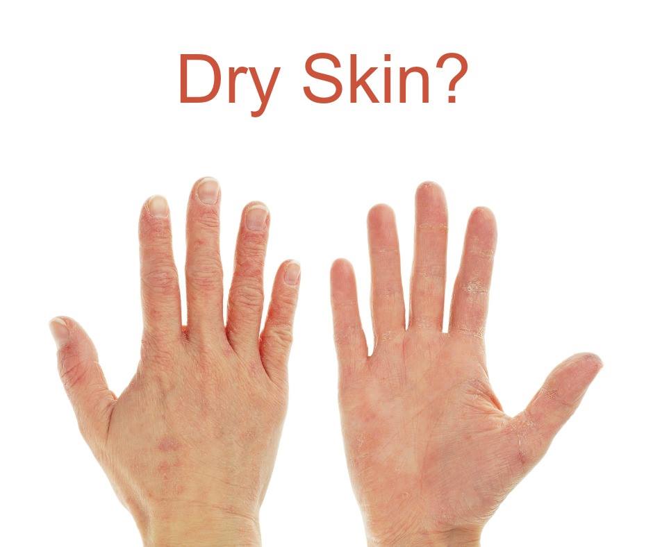 IntWell_Center's tweet image. SKIN PROBLEMS AND #HYPOTHYROID
An underactive #thyroid can cause #skin #problems. 

drrichajoy.com