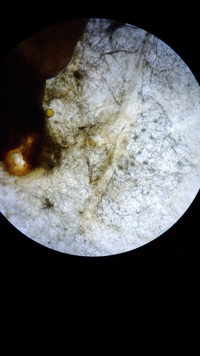 WorkCrewLH's tweet photo. Fungi under the dissecting microscope #biodiversitylab @NSPC_I (part 2) https://t.co/IJfZ7aWSqQ