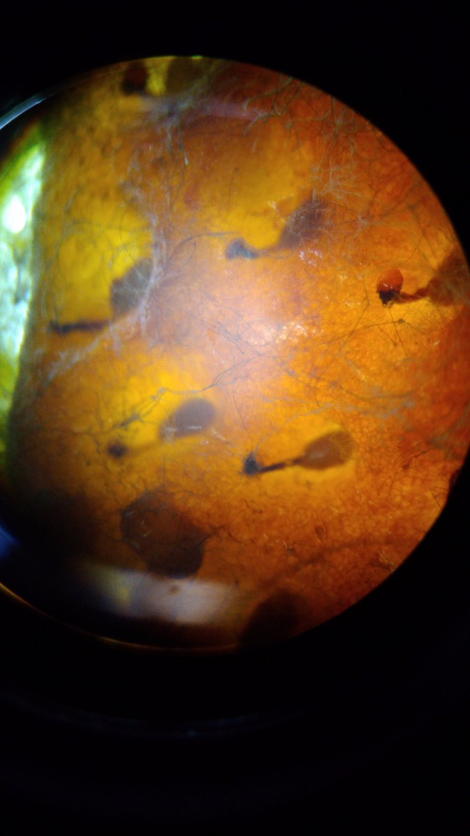 WorkCrewLH's tweet photo. Fungi under the dissecting microscope #biodiversitylab @NSPC_I (part 2) https://t.co/IJfZ7aWSqQ