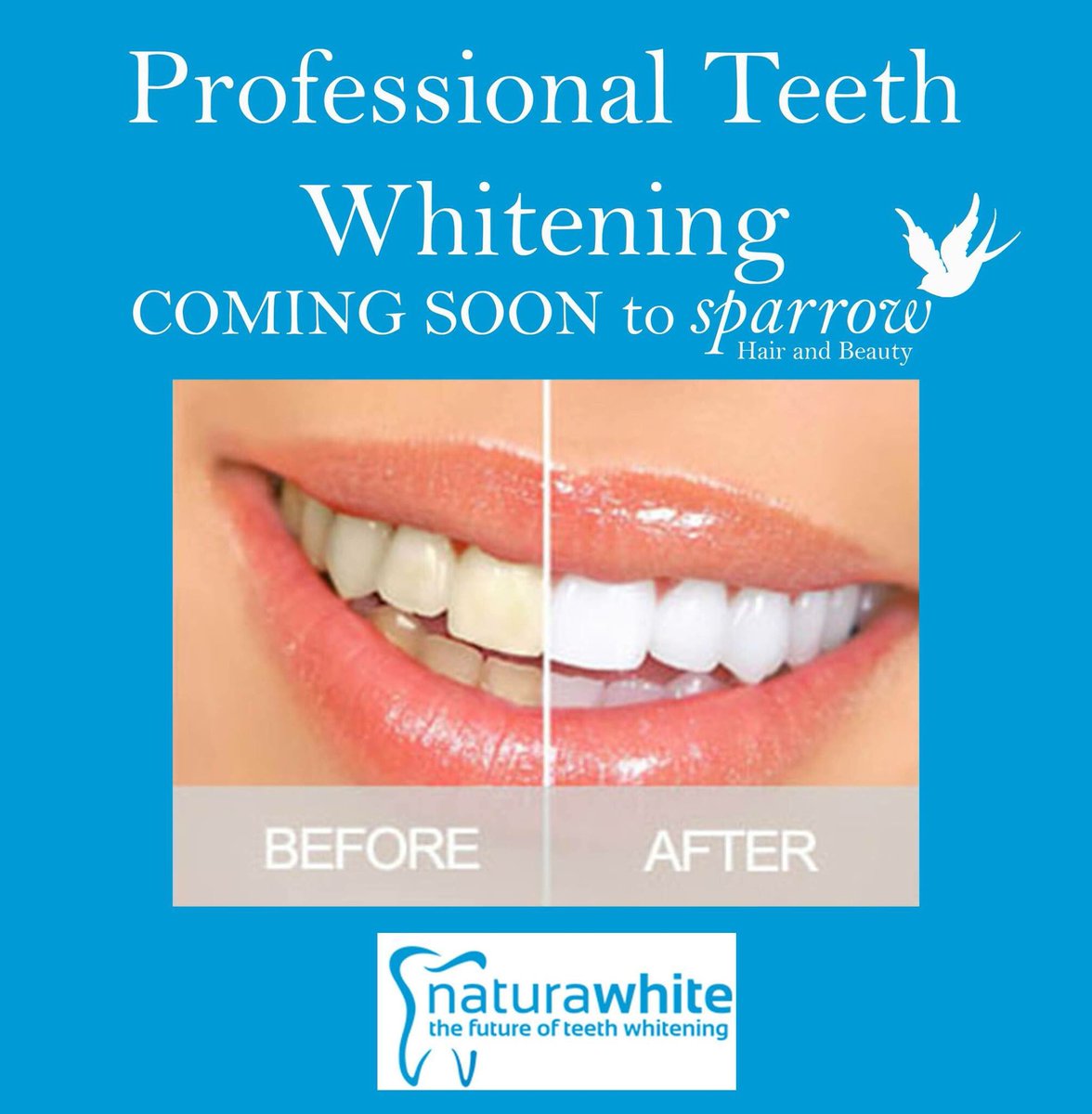 Sparrow_Salon's tweet photo. Who's wants whiter teeth? Look out for launch offers VERY soon. #naturawhite #scarborough #teethwhitening https://t.co/6yUxiwQ89r