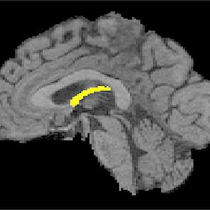 ResearchCSU's tweet photo. The secret to a healthy brain? A #ColoradoState study says dancing. #RamResearch https://t.co/xmEFHzd2Uy https://t.co/Ed4Xl3ILqH