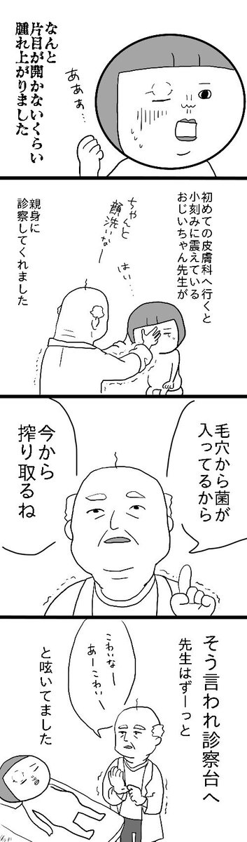 化粧を落とさずに寝るとこういうことになりかねない というお話が怖すぎた これ痛いよね Togetter 化粧を落とさずに寝るとこういうことになりかねない というお話が怖すぎた これ痛いよね Togetter