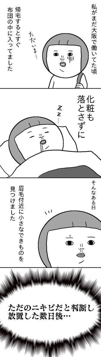 化粧を落とさずに寝るとこういうことになりかねない というお話が怖すぎた これ痛いよね Togetter 化粧を落とさずに寝るとこういうことになりかねない というお話が怖すぎた これ痛いよね Togetter