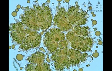 PhycoTechInc's tweet photo. #Botryococcus Day 2 with oil droplets! #Chlorophyte  #supercoolalgae #Ilovemyjob https://t.co/9yKsNnTQRx